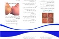 زخم و شقاق پستان